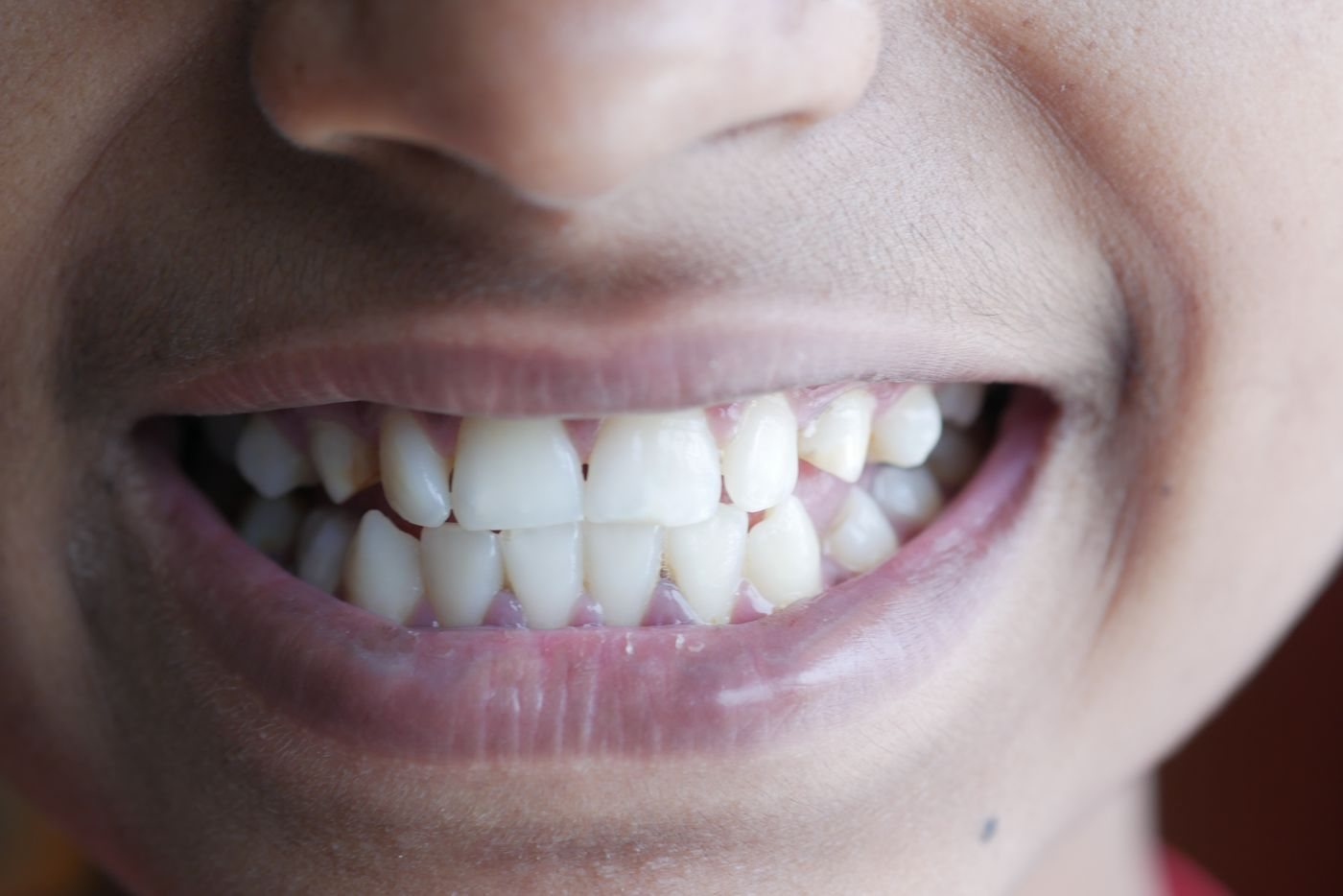 Sorriso saudável em close